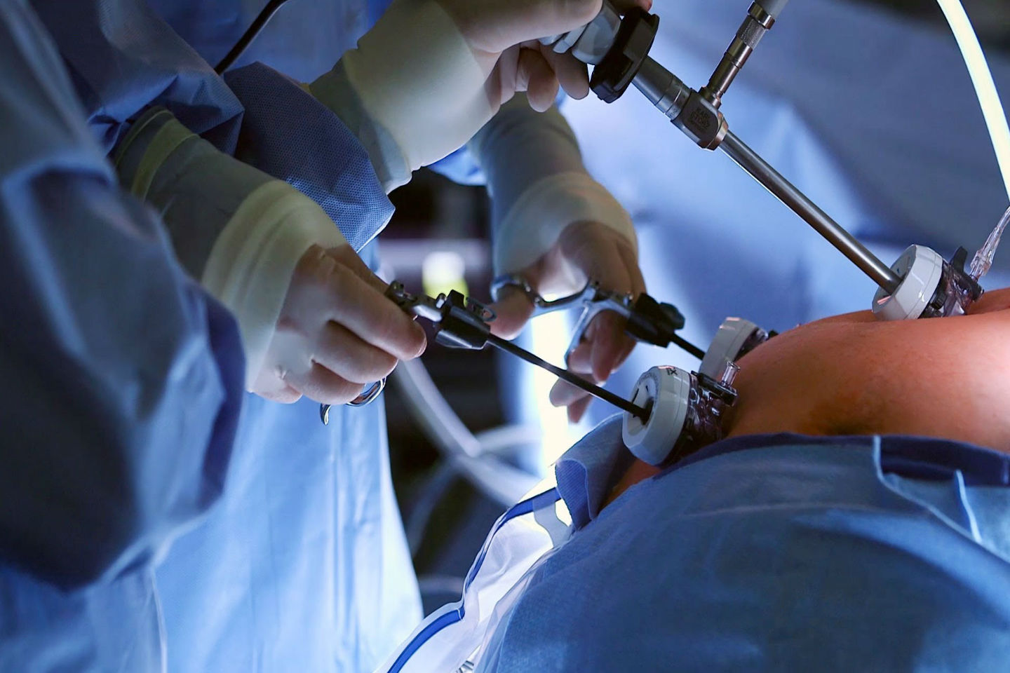 Η βαριατρική χειρουργική βελτιώνει την κατάσταση της καρδιάς