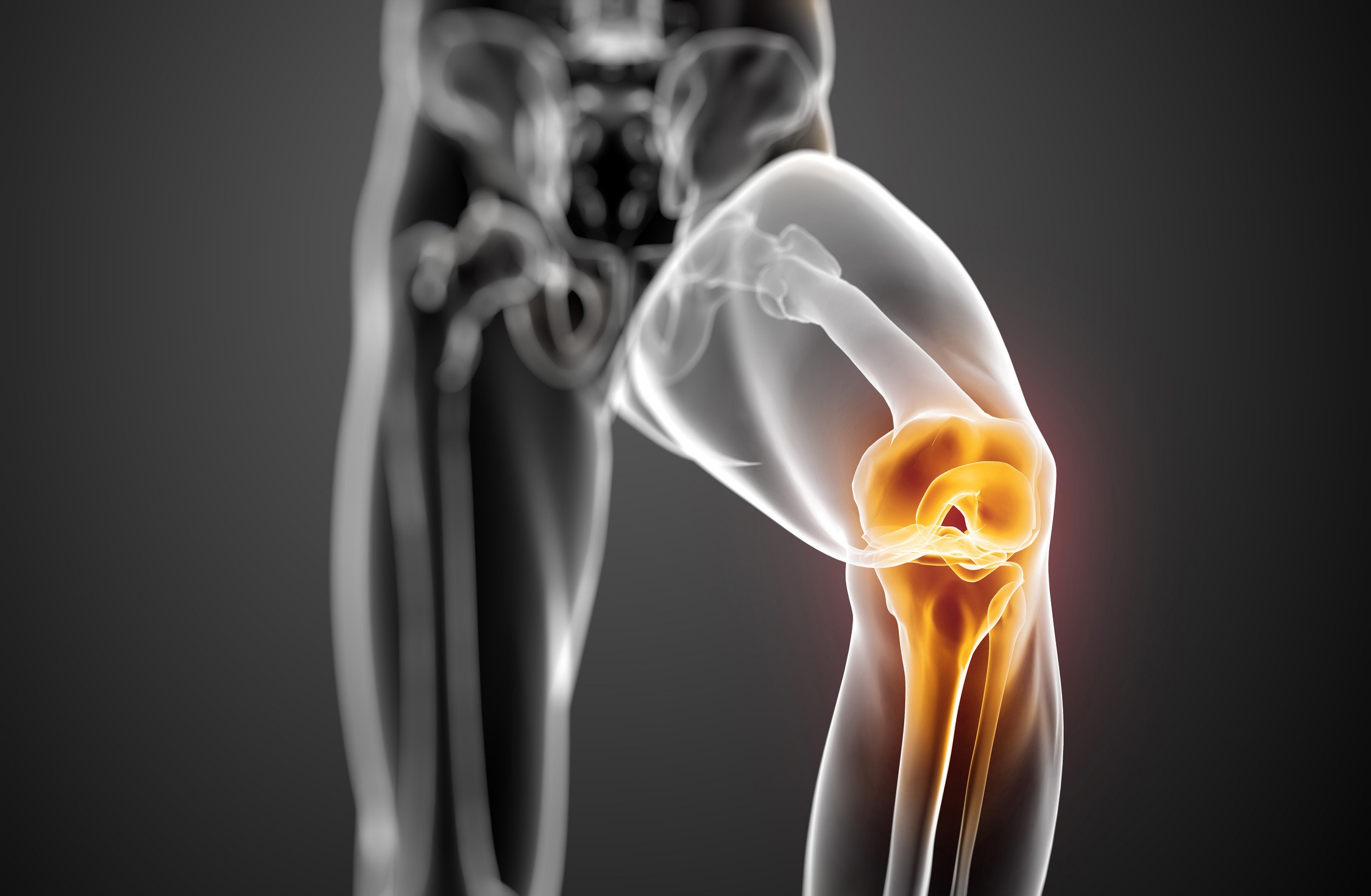 Μη επεμβατική θεραπεία για την επώδυνη οστεοαρθρίτιδα του γόνατος
