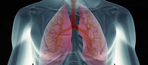 Πότε οι πνεύμονες είναι πιο συμβατοί για μεταμόσχευση;