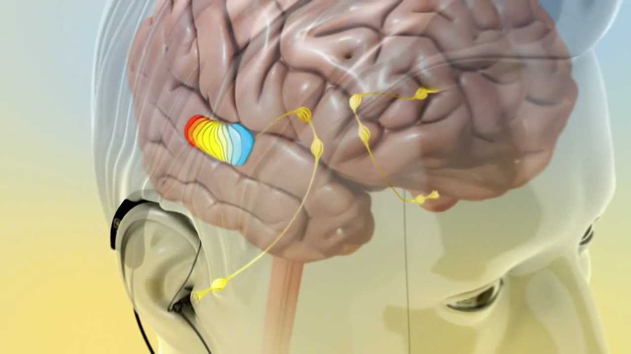 Απομονώθηκαν οι εγκεφαλικοί νευρώνες που επηρεάζουν την επιθυμία για …