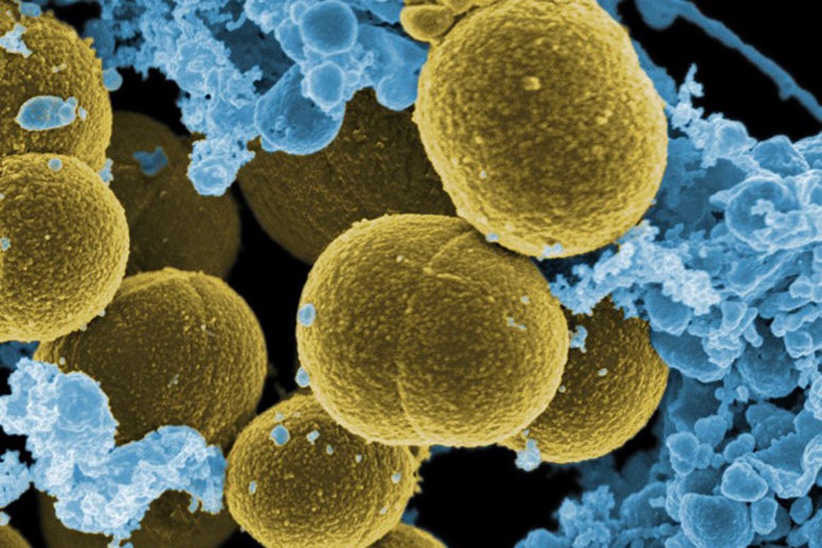 Ανακαλύφθηκε το πρώτο βακτήριο που προστατεύει τον καρκίνο
