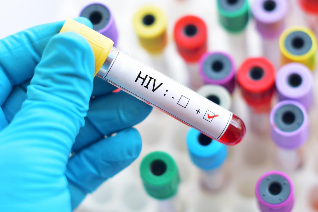 Μελέτη διερευνά τα “κλειδιά” του HIV