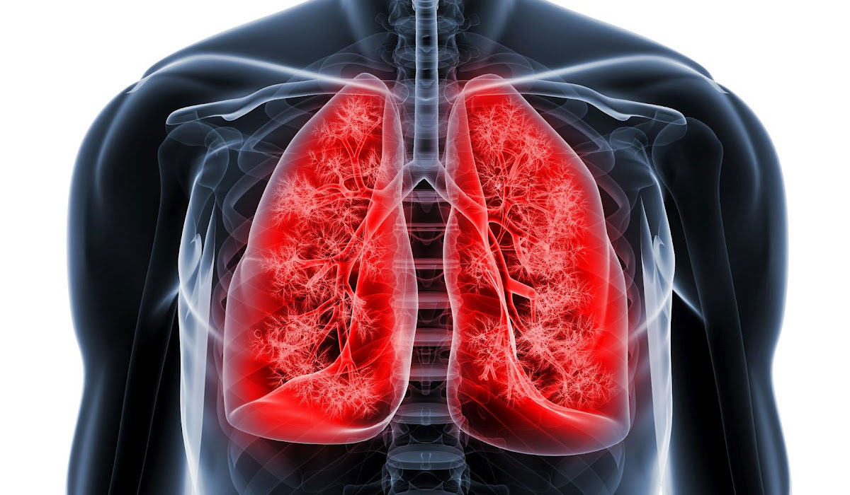 Έγκαιρη ανίχνευση καρκίνου του πνεύμονα – Πως;