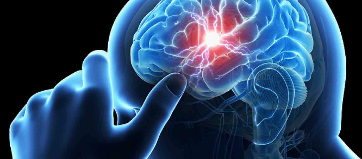 Νέα επιστημονικά δεδομένα για τη θεραπεία του εγκεφαλικού