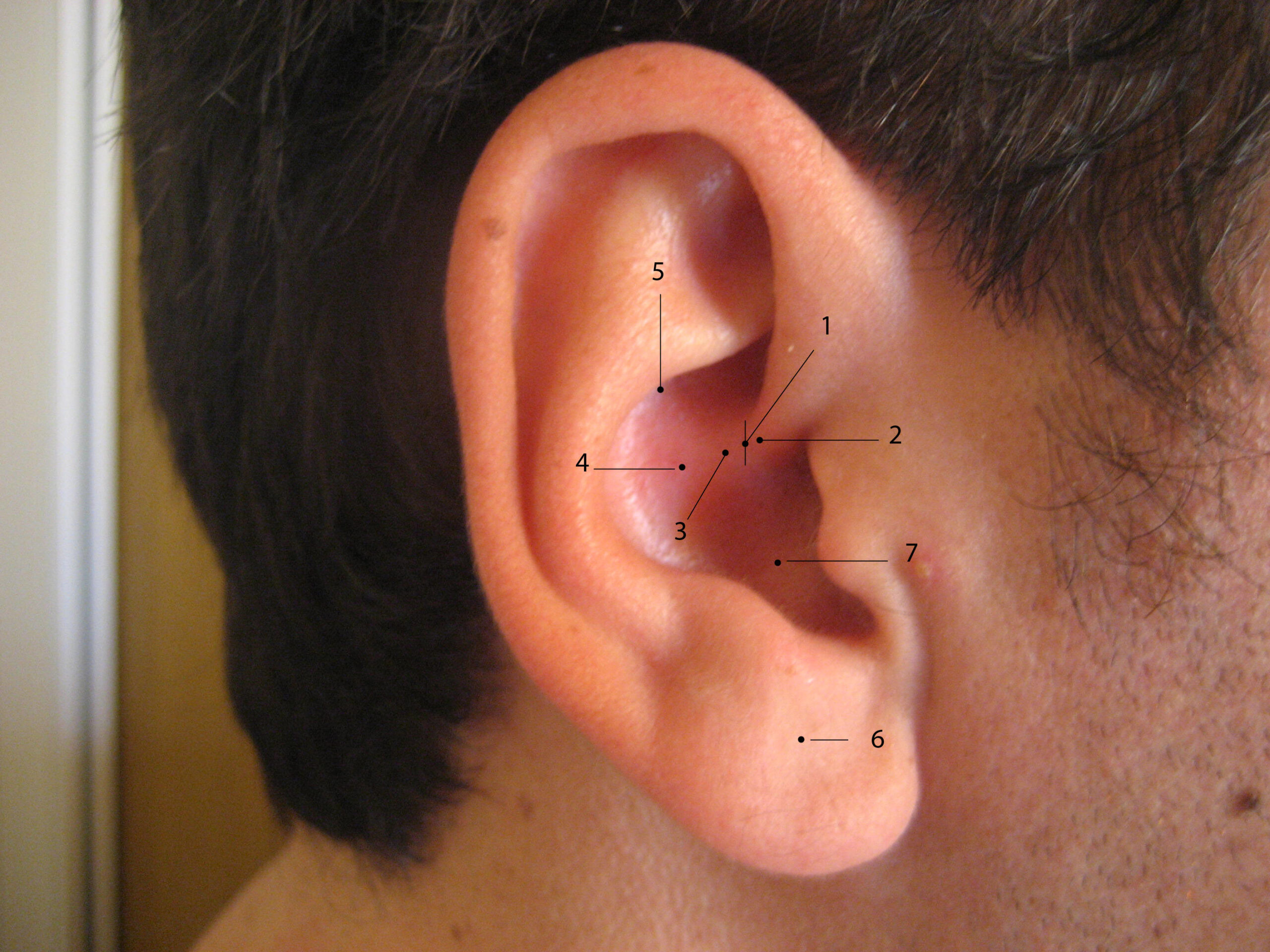 Έξι εύκολες μέθοδοι για να βγάζετε νερό από το αυτί