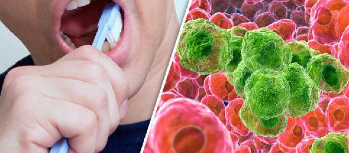 Πως σχετίζεται ο καρκίνος του οισοφάγου με τα βακτήρια στο στόμα