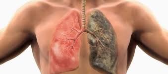 Tροφές για τον καθαρισμό των πνευμόνων από τη νικοτίνη