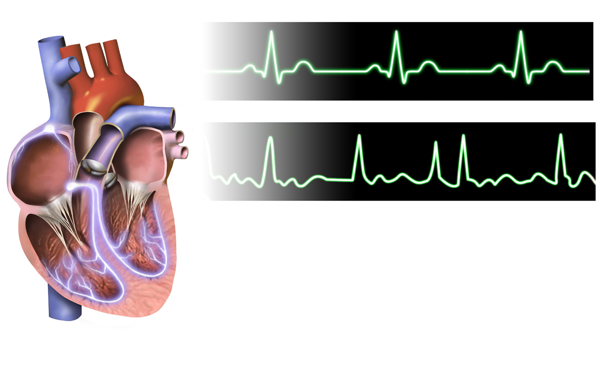 Τρισδιάστατη ιατρική απεικόνιση για την ανίχνευση καρδιακών παλμών