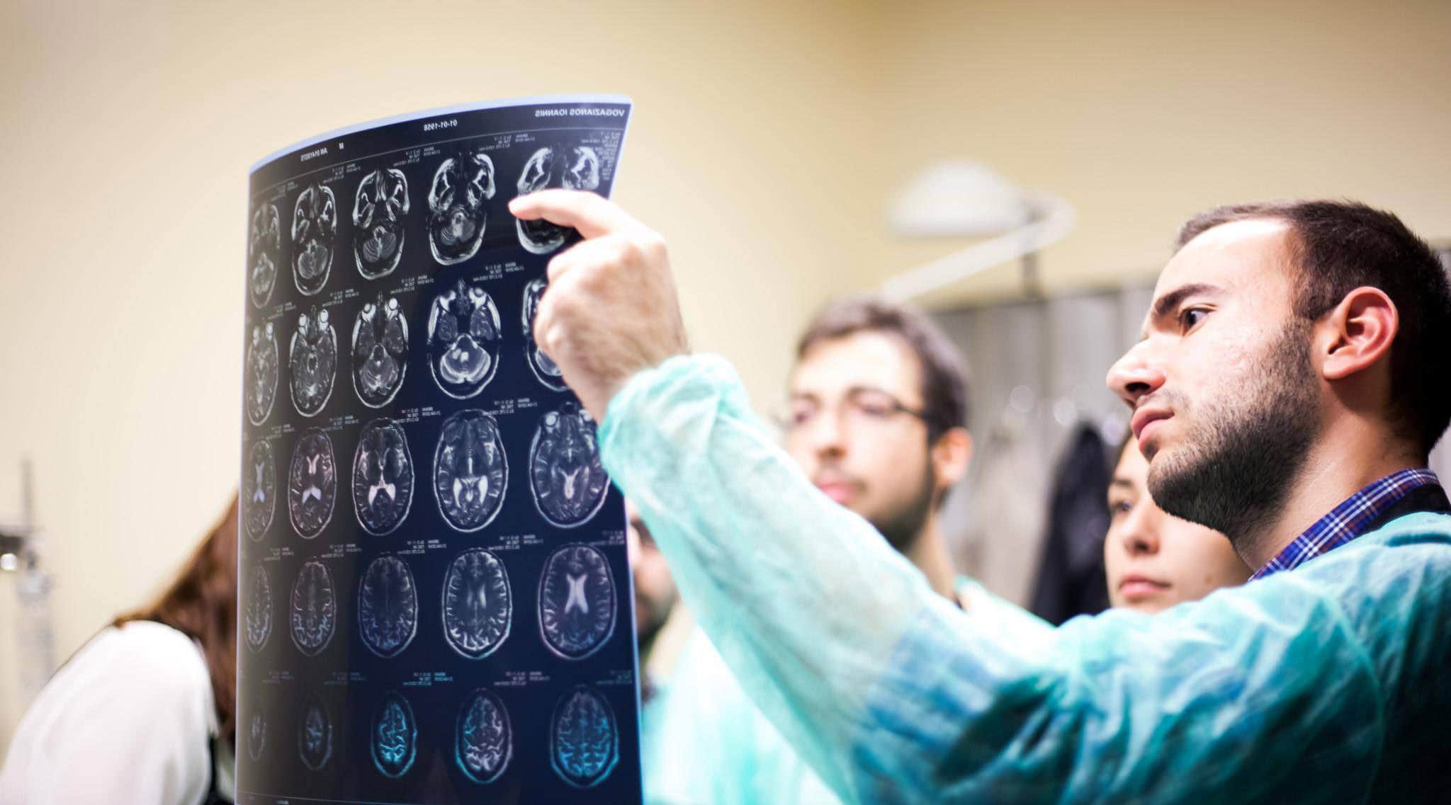 Νέα μέθοδος για τη διείσδυση στον εγκέφαλο των ογκολογικών φαρμάκων