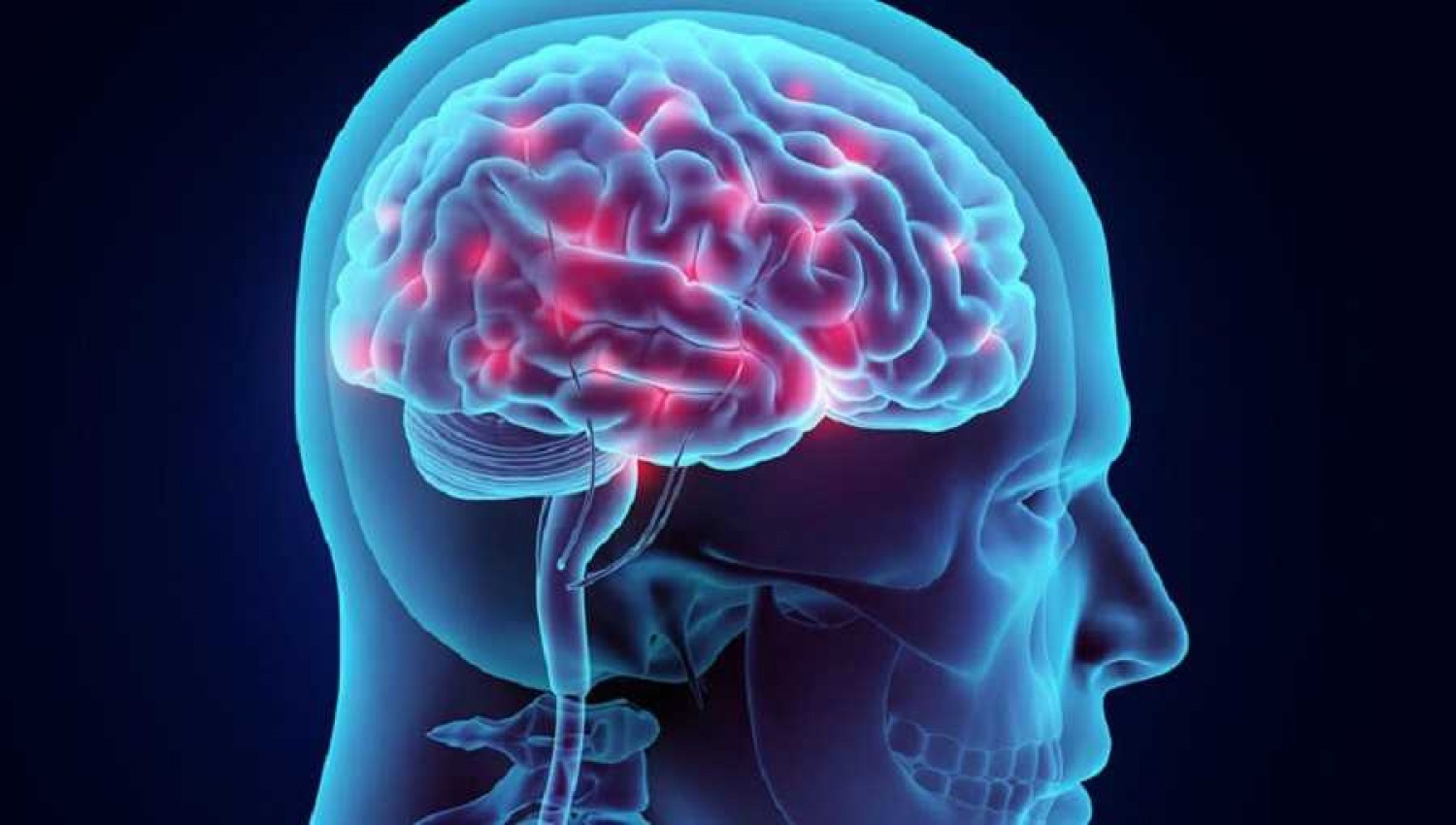Ποιος παράγοντας μπορεί να προκαλέσει συρρίκνωση του εγκεφάλου