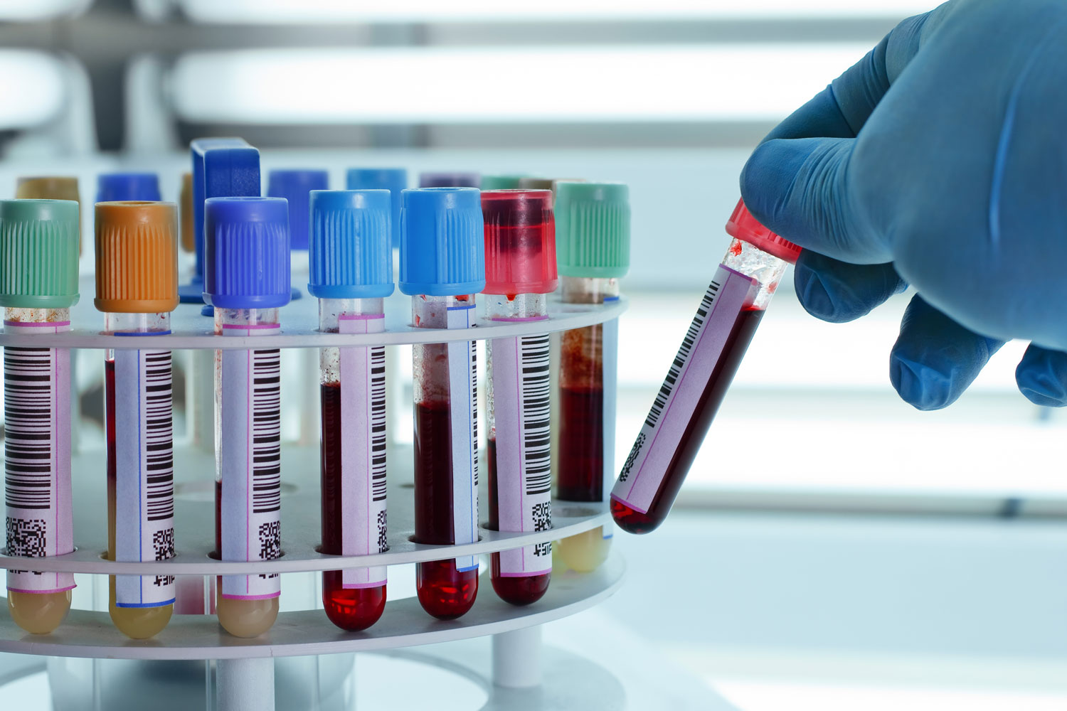 Πειραματικό τεστ αίματος ανιχνεύει τον καρκίνο στο σώμα