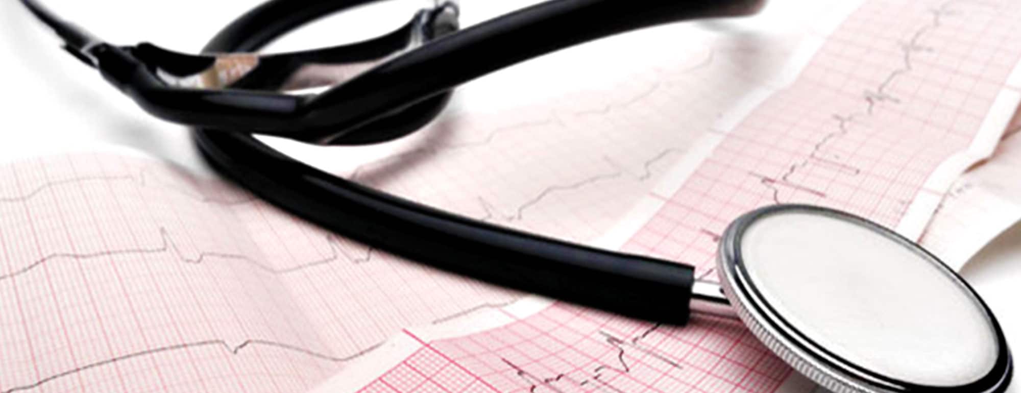 Νέα μελέτη δείχνει από τι προκαλούνται οι καρδιακές αρρυθμίες