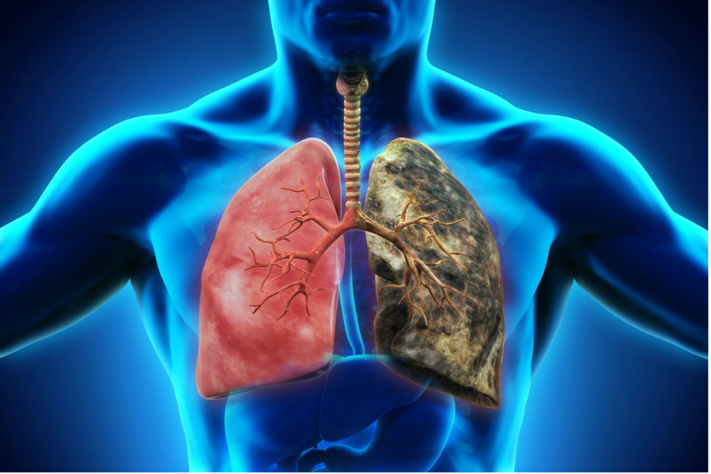 Νέα επιστημονικά δεδομένα για τις χρόνιες ασθένειες των πνευμόνων