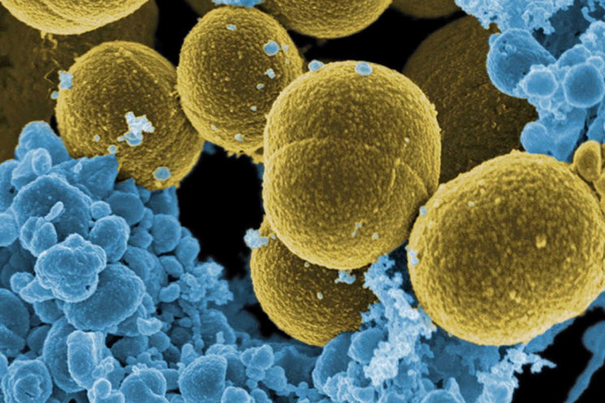 “Καμπανάκι” για μεταφορά επικίνδυνου μικροβίου μέσω ιατρικού τουρισμού