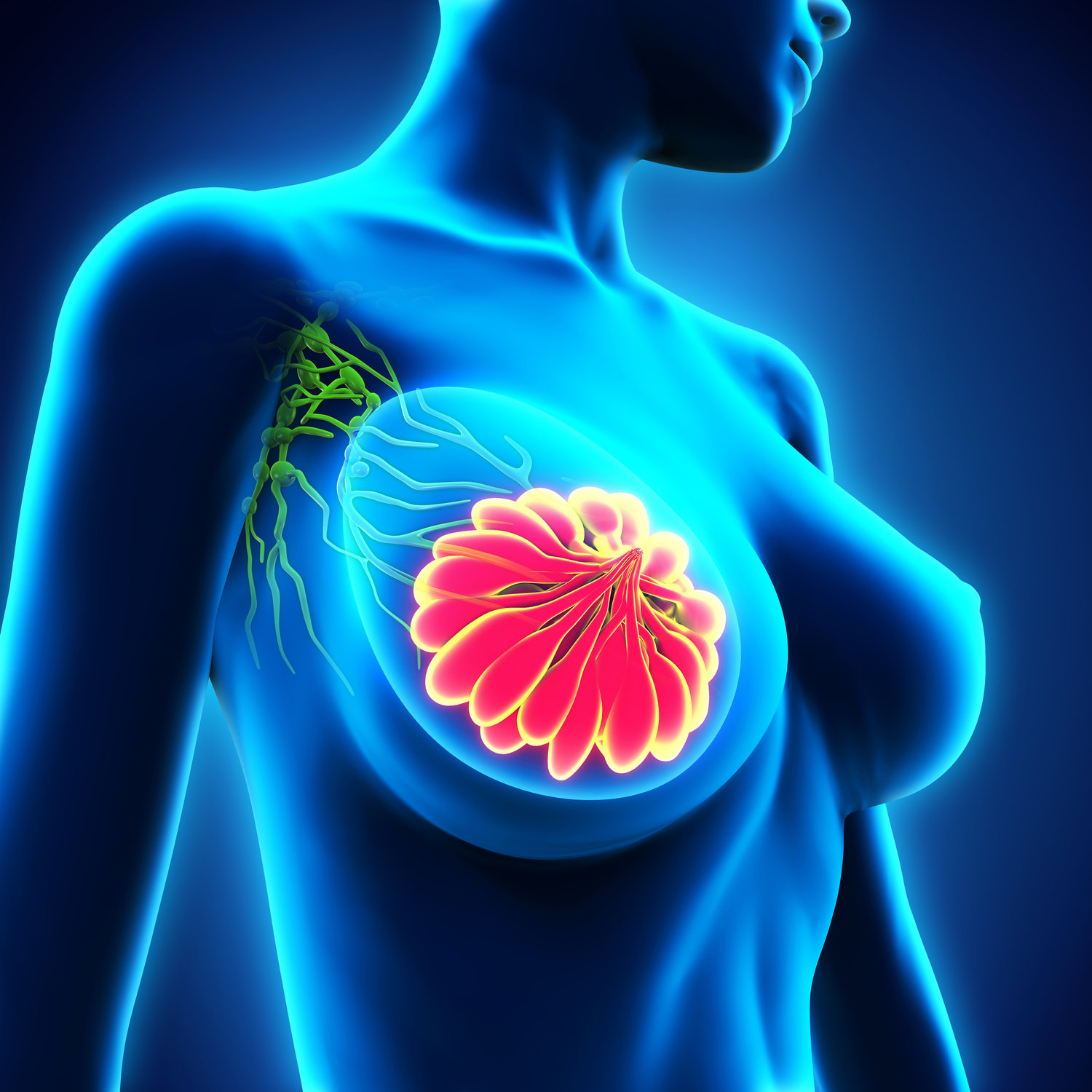 Καρκίνος μαστού: Τι συμβαίνει όταν ο καρκίνος εξαπλώνεται στους πνεύμονες-Nέα μελέτη
