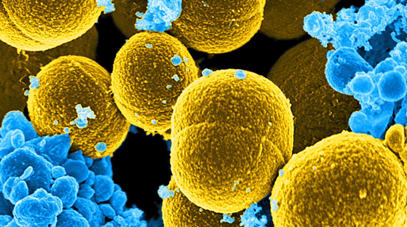 Nέα μέθοδος για την αποσύνθεση των superbugs
