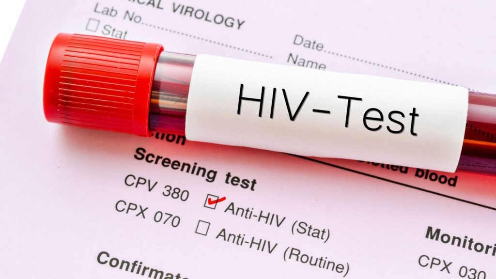 Νέα θεραπεία καταστέλλει πλήρως τη λοίμωξη από τον ιό HIV