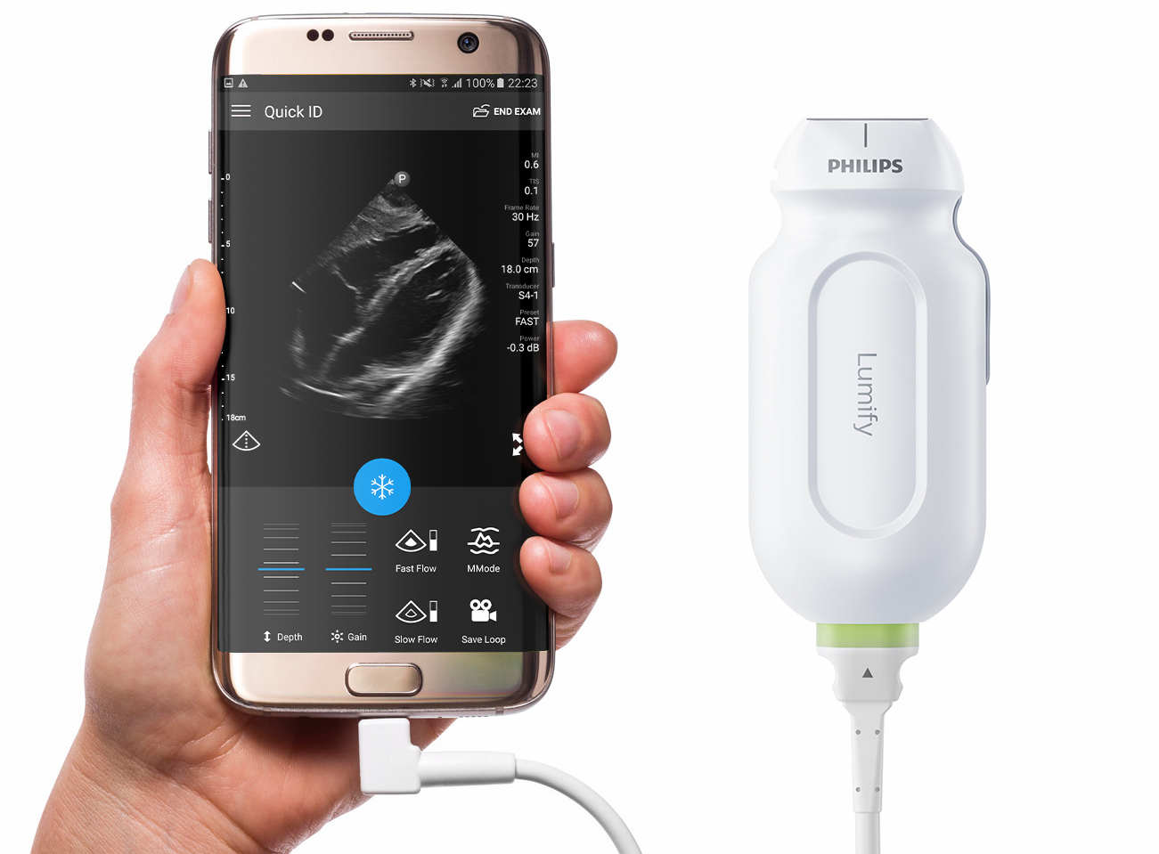 Lumify : Κάνεις υπέρηχο από το κινητό σου | healthweb.gr