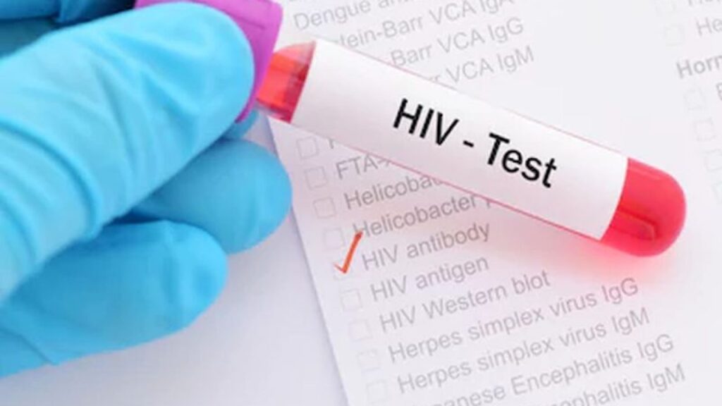 Νέα ανακάλυψη για την καταπολέμηση του HIV