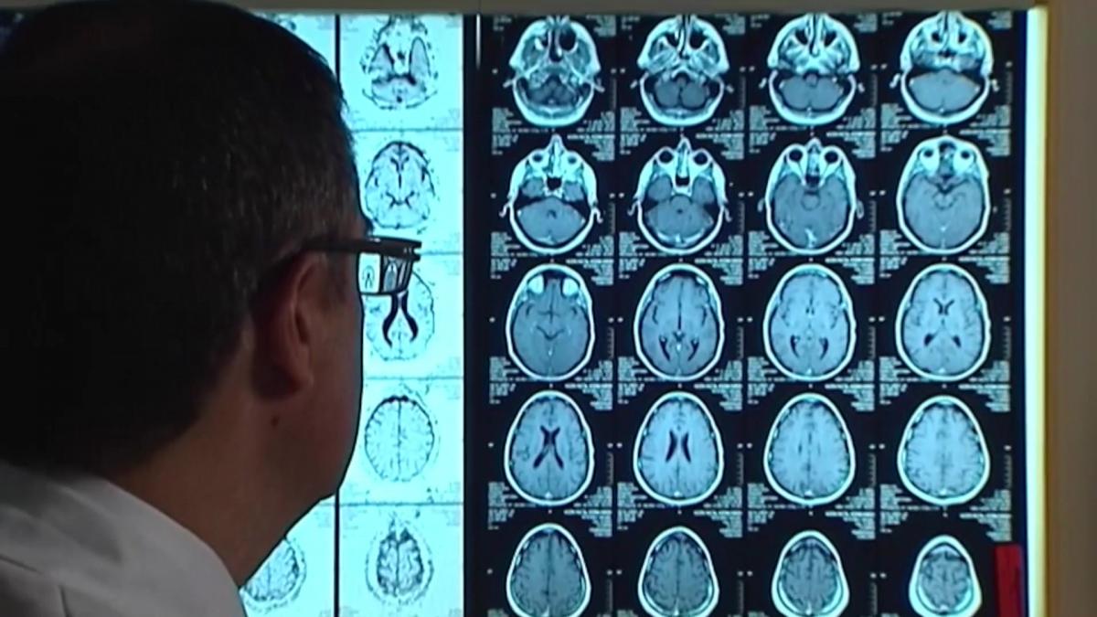 Πως η νόσος Αλτσχάιμερ καταστρέφει τους νευρώνες που μας κρατούν ξύπνιους