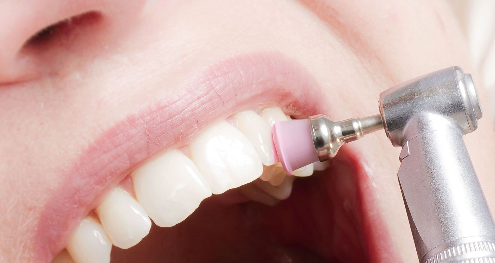 Φυσικοί τρόποι αντιμετώπισης οδοντικού αποστήματος
