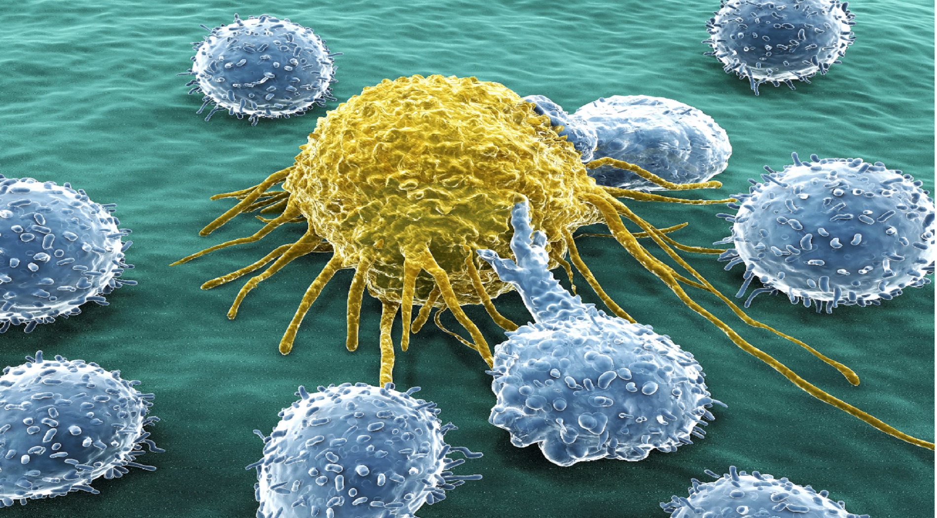 Οι επιστήμονες βοηθούν το ανοσοποιητικό να βρει καρκινικά κύτταρα
