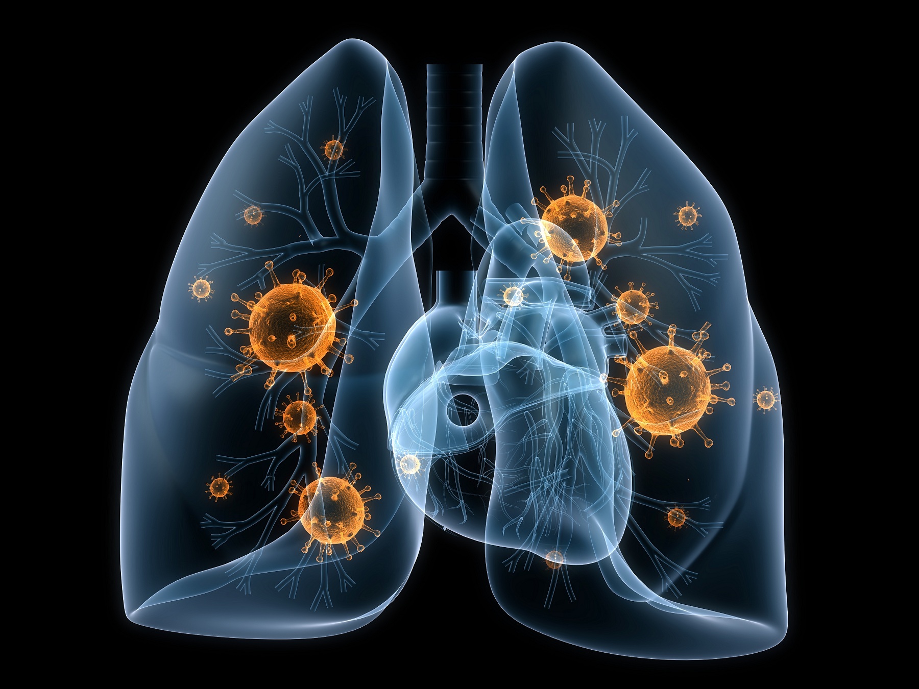 Νέα στοιχεία για την πνευμονιοκοκκική νόσο