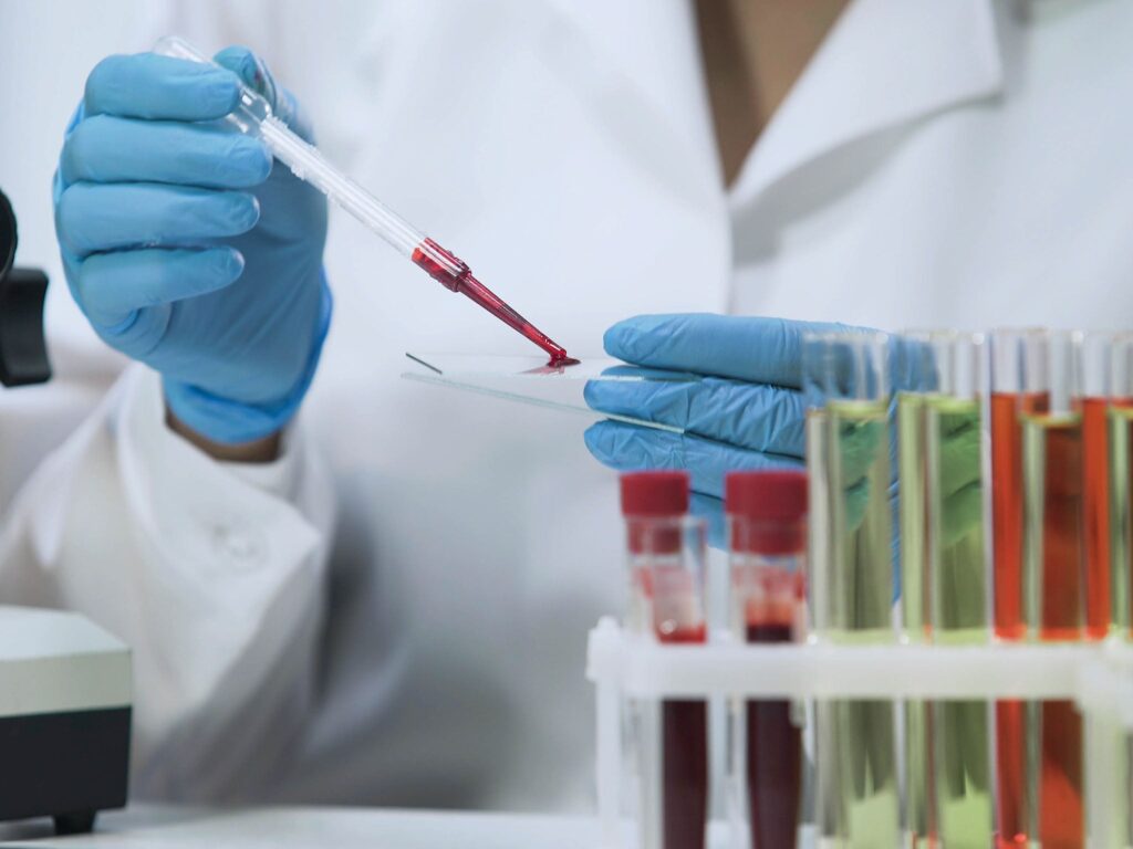 Το εργαστήριο των ΗΠΑ αναγνωρίζει σπάνια νέο στέλεχος του ιού HIV