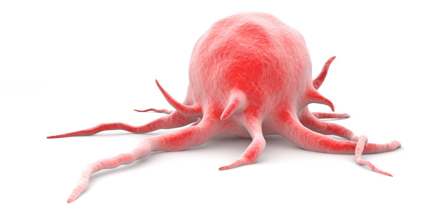 cancer proktos