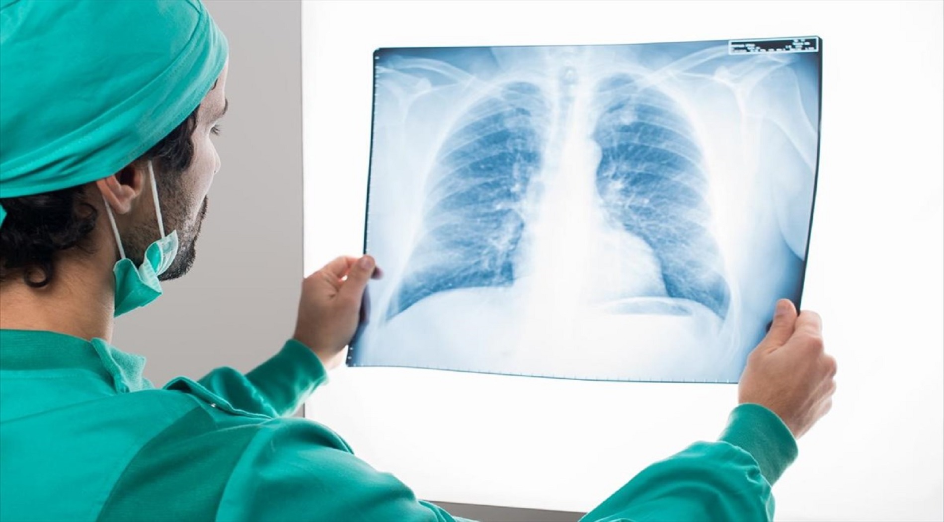 Πνεύμονες: Ο συνδυασμός που επιβαρύνει σημαντικά το αναπνευστικό σύστημα