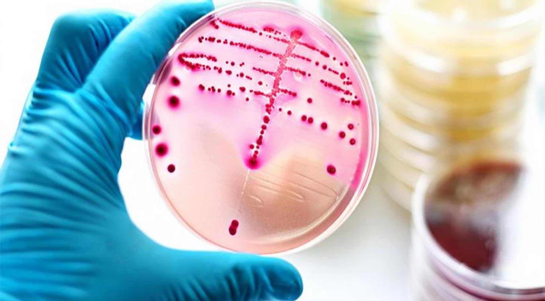 Πώς εντοπίζονται οι βακτηριακές λοιμώξεις