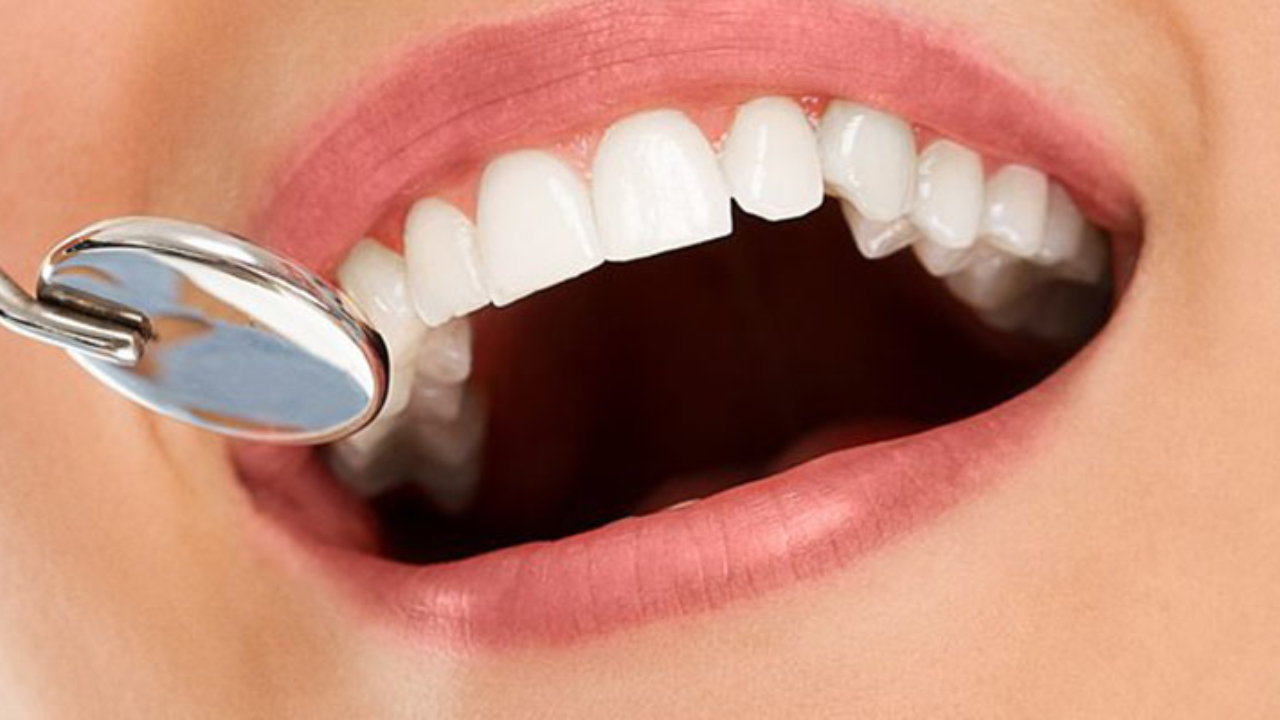 Μυστικά για να προλάβετε το κιτρίνισμα των δοντιών
