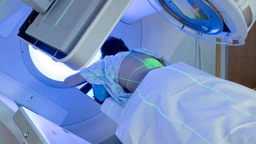 radiotherapia