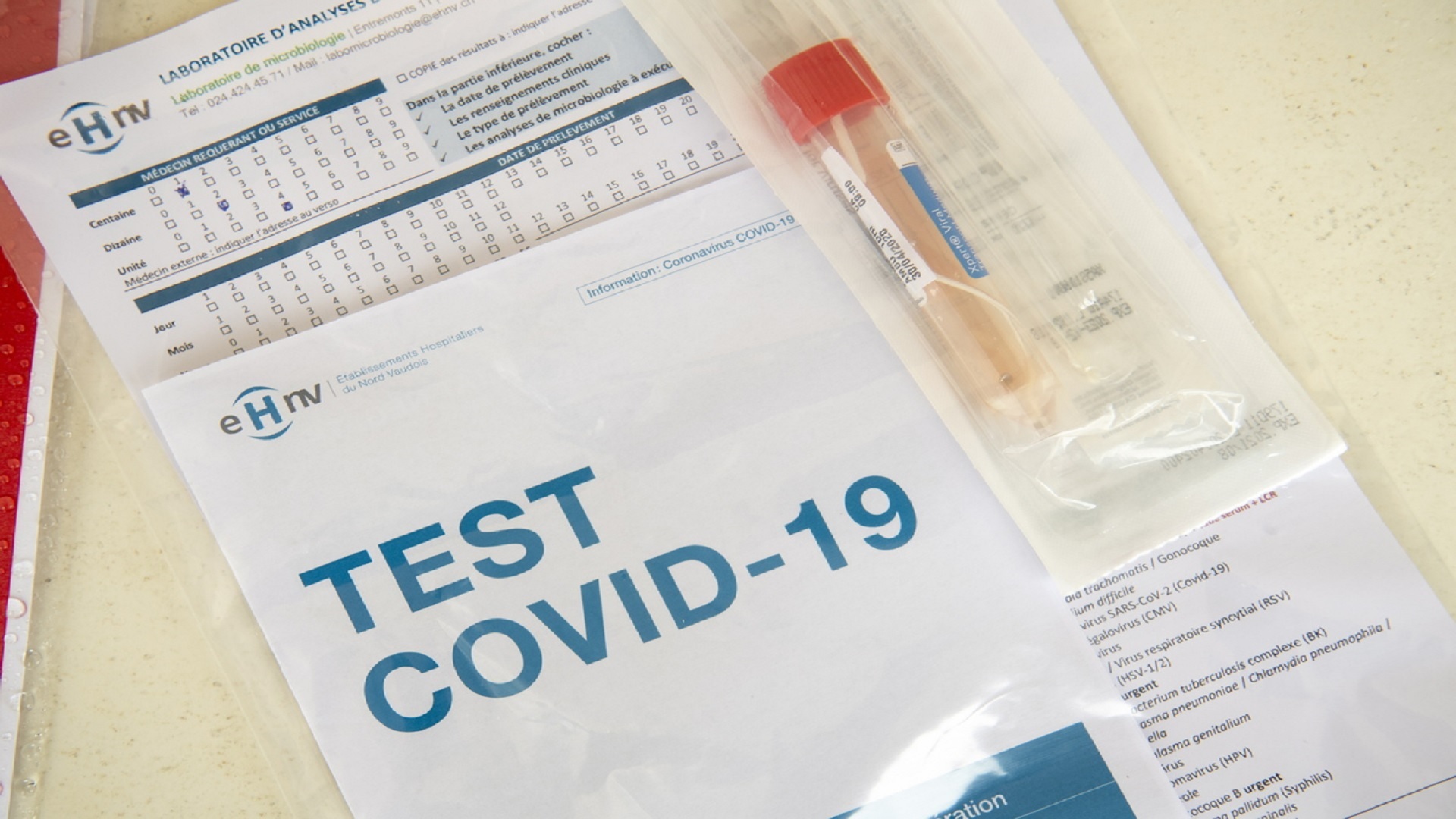 Απαιτούνται πολλά βήματα για ακριβή αποτελέσματα δοκιμών COVID-19