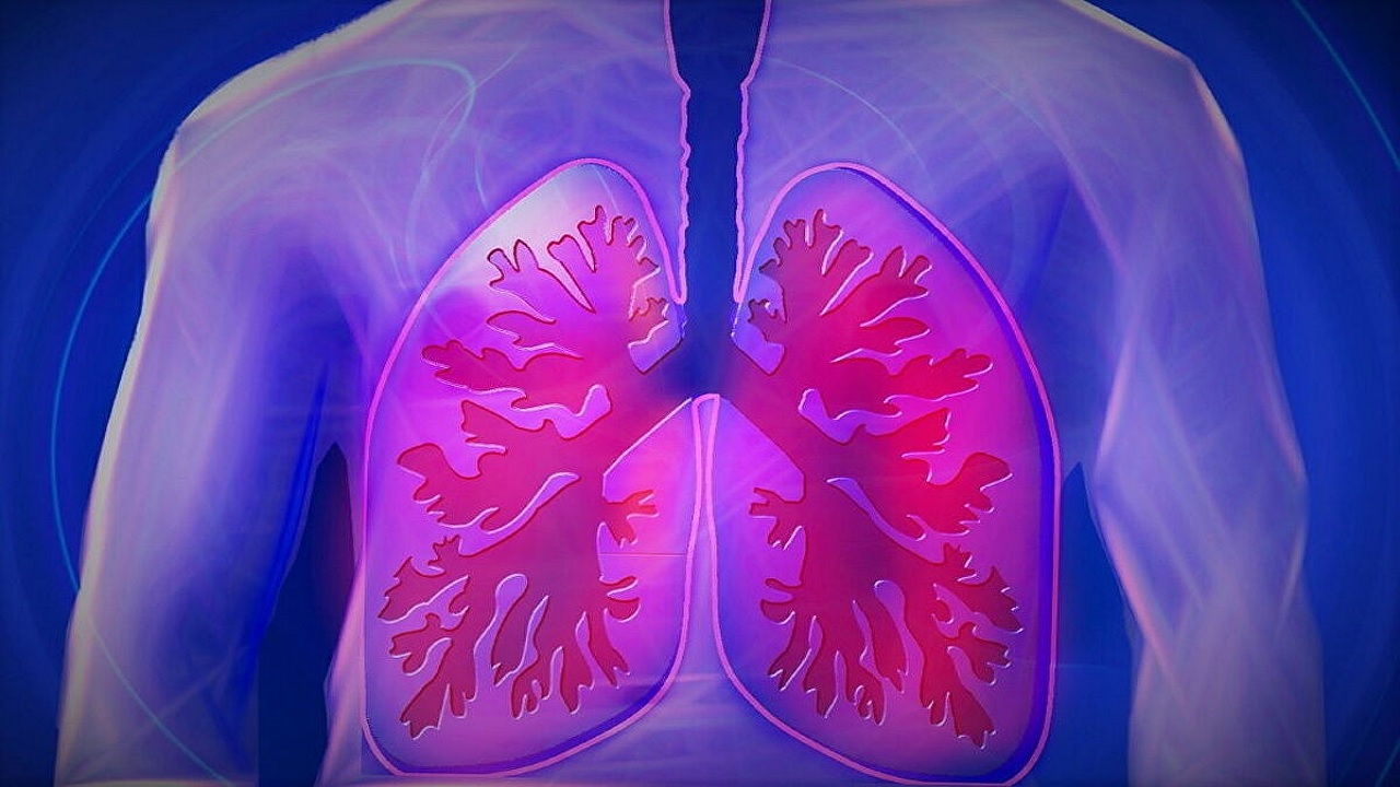 Κορωνοϊός πνεύμονες: οι επίμονες βλάβες των ασθενών μετά το εξιτήριο