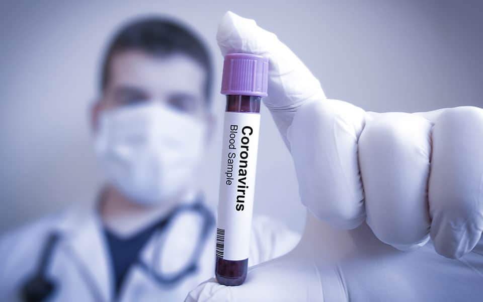 coronavirus test