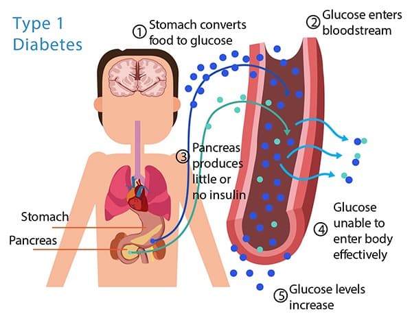 diabetes1.jpg