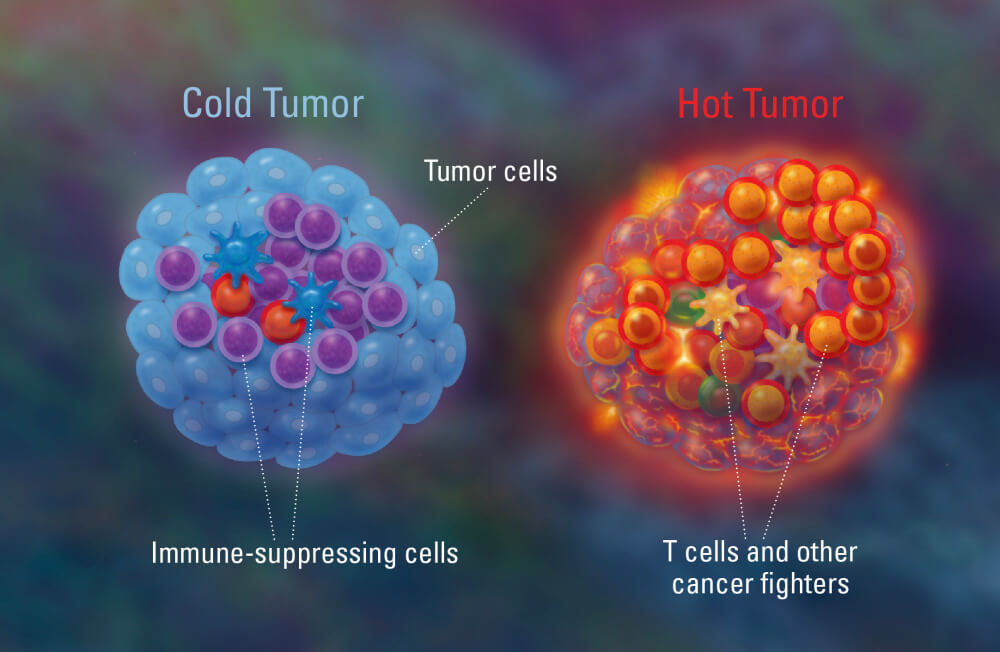 Tumor-Art.jpg