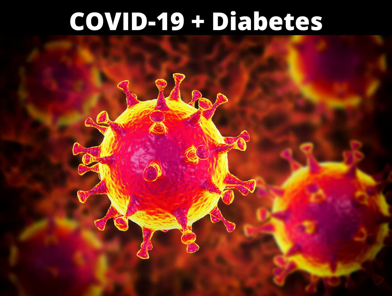 Σακχαρωδης Διαβητης τύπου 1 νοσηλεία: Η έκβαση των ασθενών με λοίμωξη COVID-19