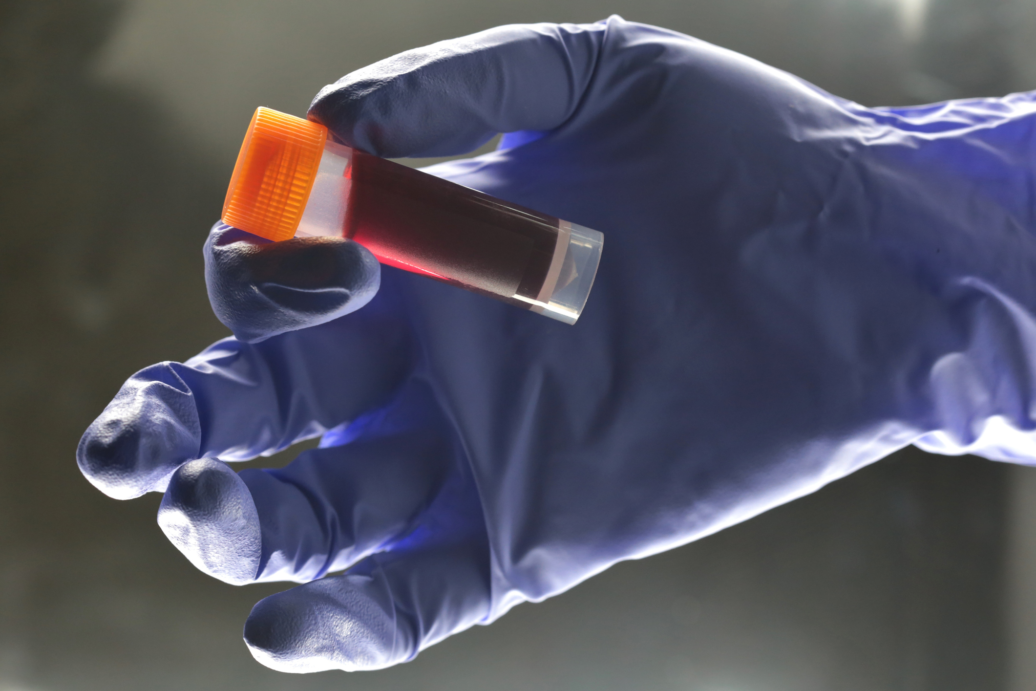 Κορωνοϊός ομάδα αίματος: Ποιος τύπος αυξάνει τον κίνδυνο μόλυνσης;