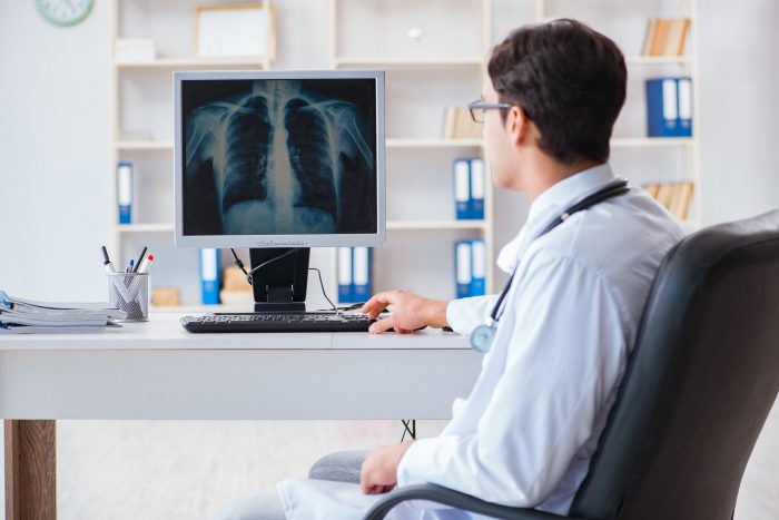 Καρκίνο του πνεύμονα: Μονοθεραπεία αυξάνει την επιβίωση των ασθενών