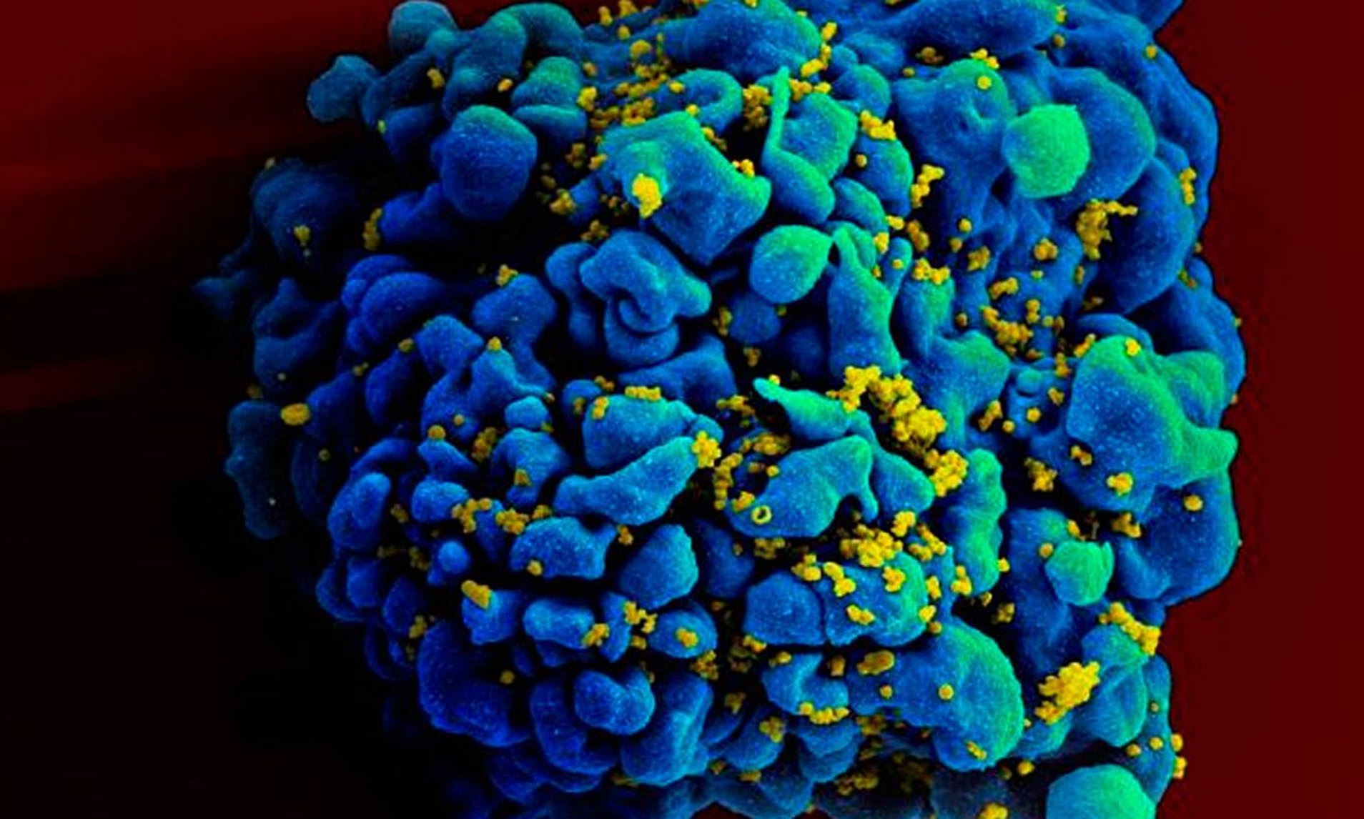 Chapare ιός: Μία νέα απειλή για την ανθρωπότητα