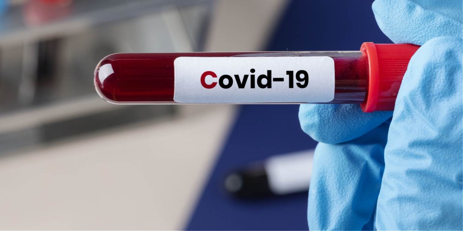 Κορωνοϊός Συμπτώματα: Νέο ενδεικτικό σημάδι της Covid-19