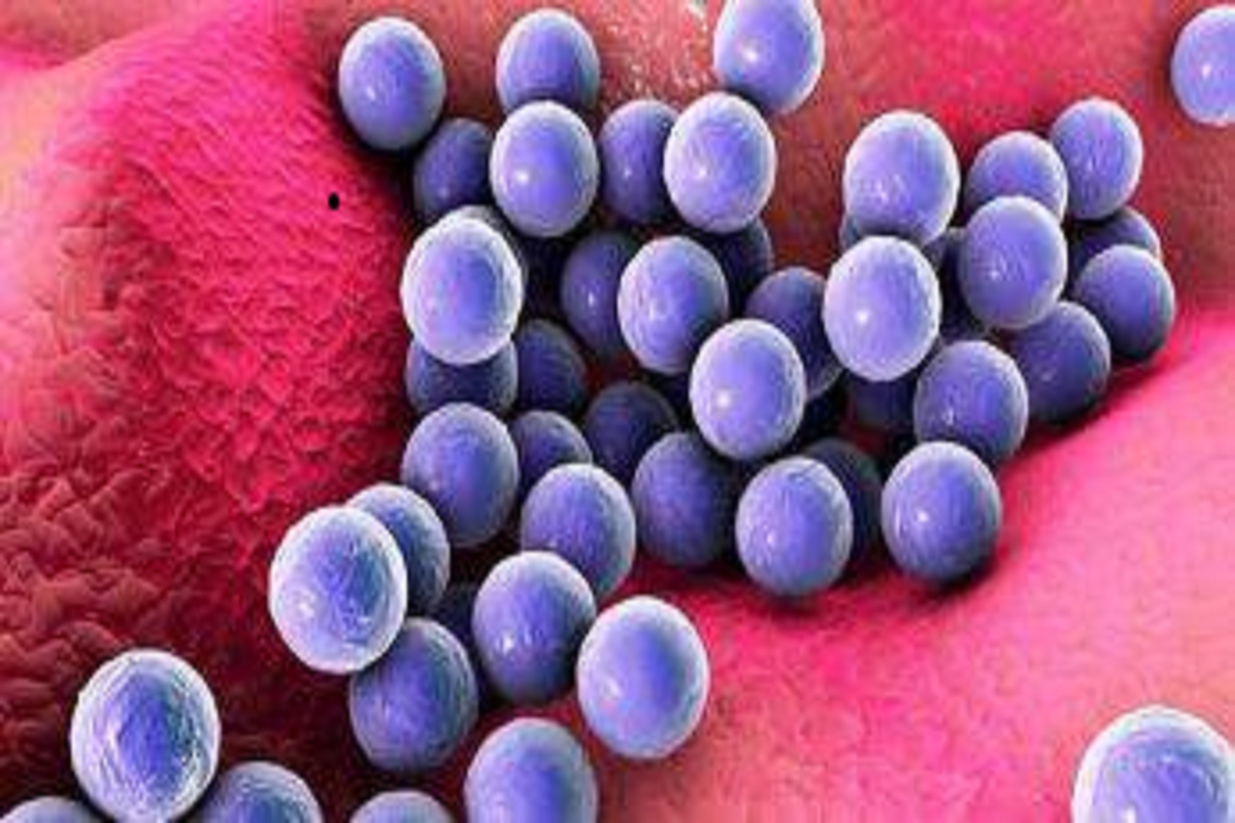 Σταφυλόκοκκος Βακτήρια: Πώς μεταδίδεται – τρόπος πρόληψης ή αντιμετώπισης