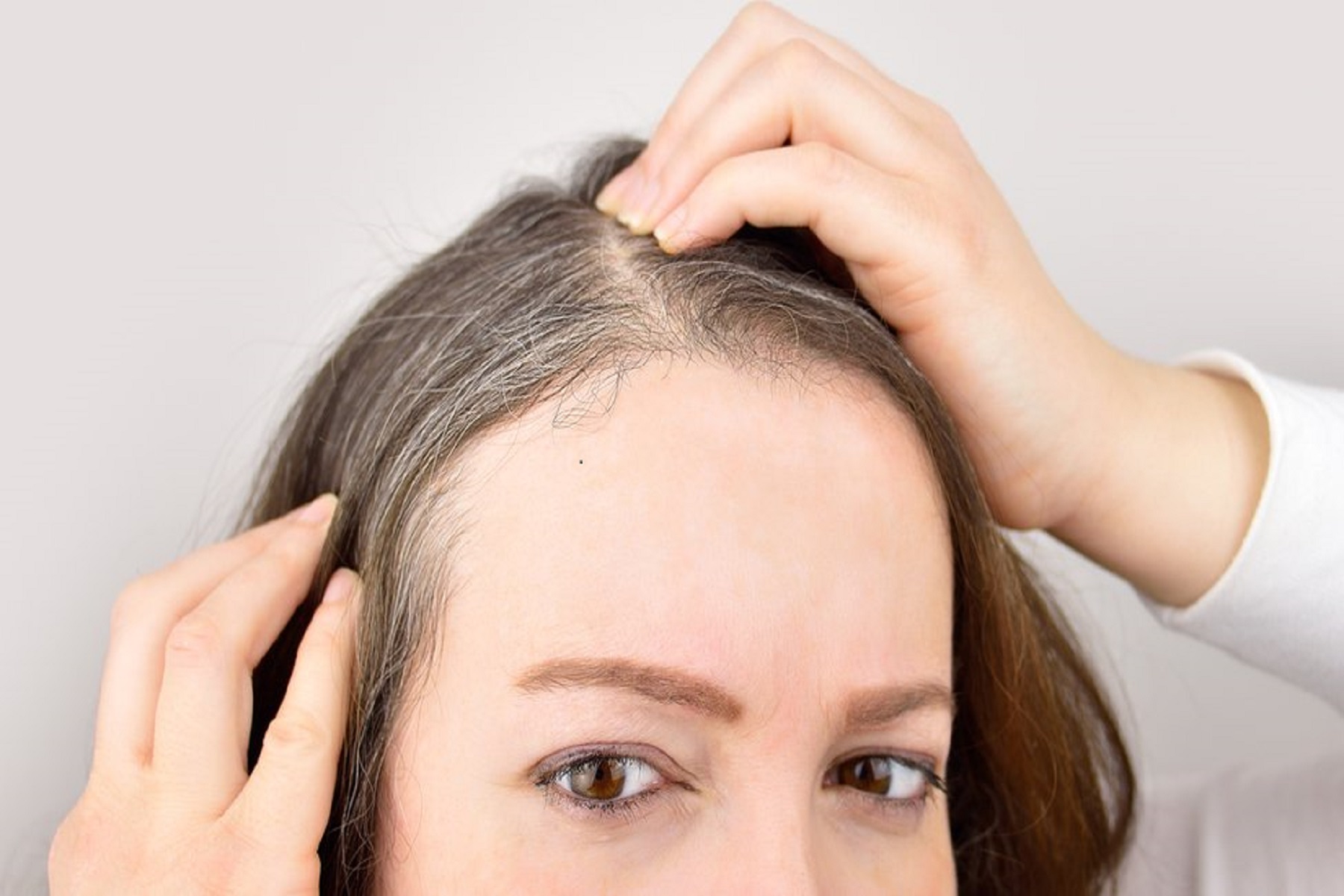 Άγχος Μαλλιά: Έρευνα του Harvard επιβεβαιώνει ότι το στρες μπορεί  να ασπρίσει τα μαλλιά μας