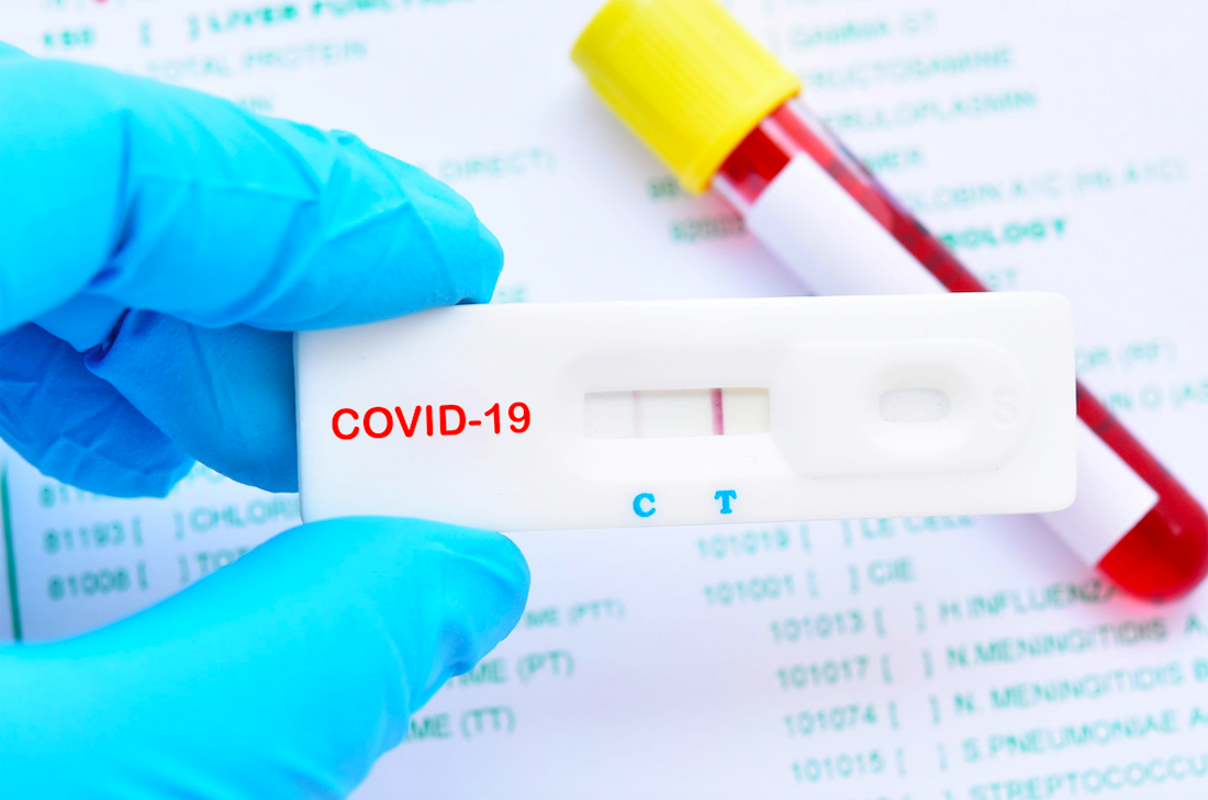 Κορωνοϊός αντισώματα τεστ: Ανιχνεύει ποιος χρειάζεται εμβολιασμό