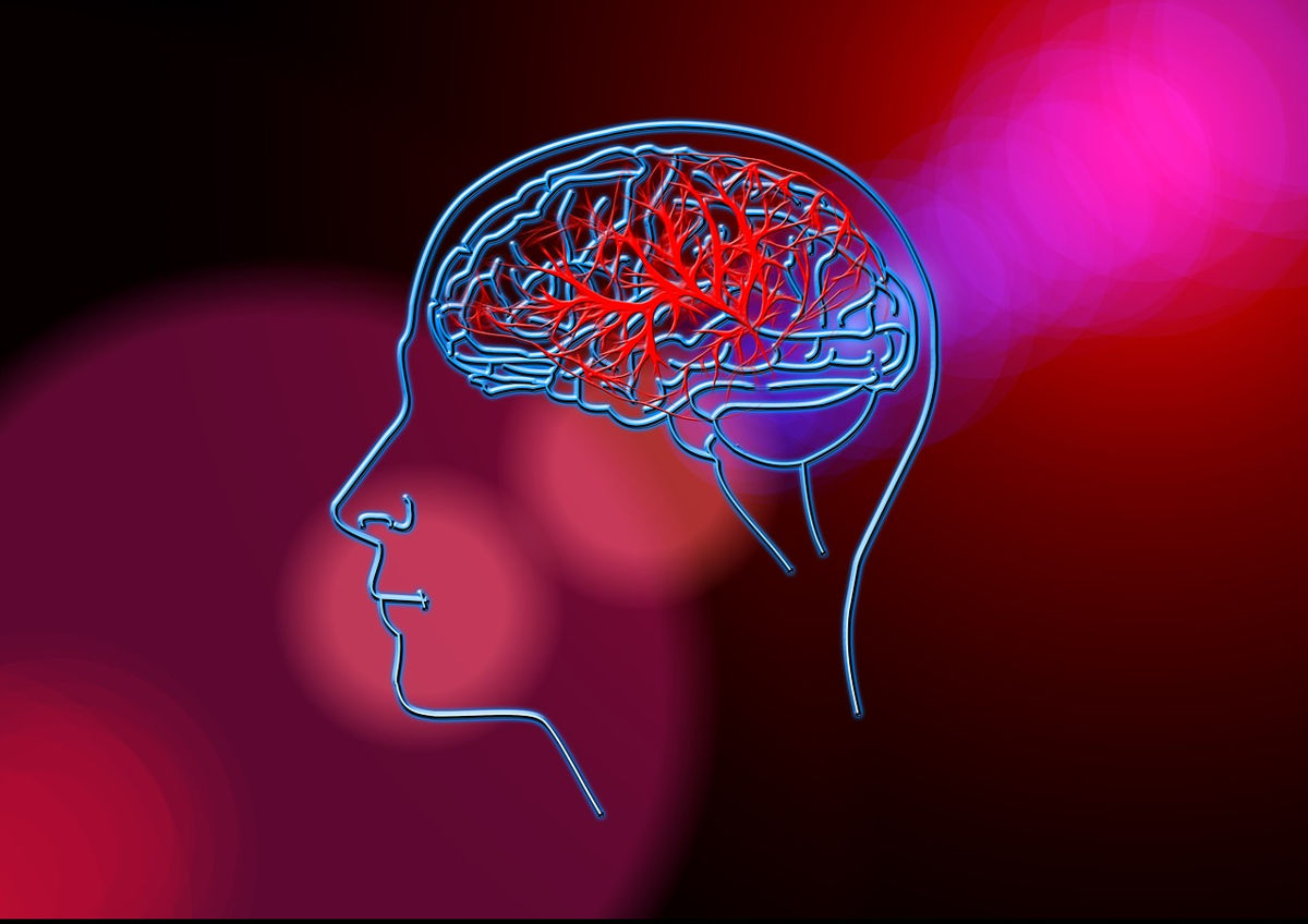 Εγκεφαλικό επεισόδιο: Ανακαλύφθηκε πιθανή νέα στρατηγική συνταγών