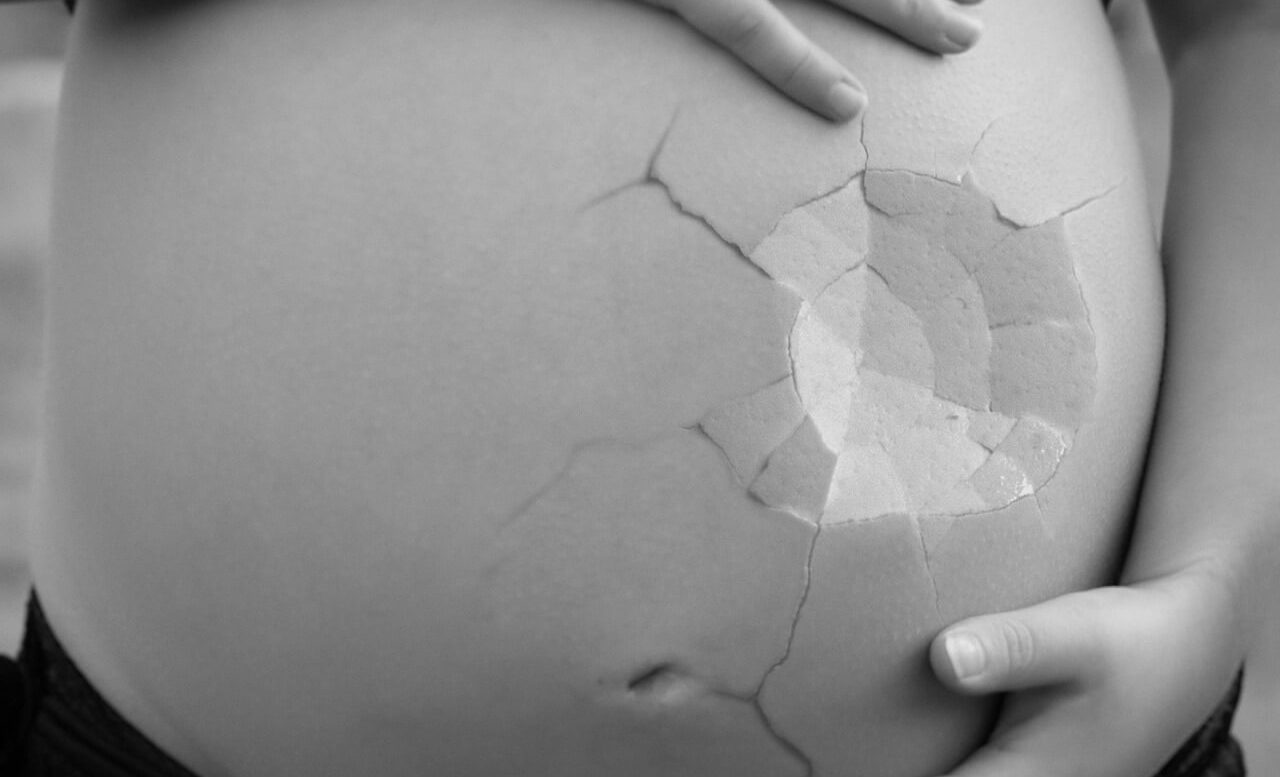 Κορωνοϊός εγκυμοσύνη: Αποβολή εμβρύου εν μέσω πανδημίας