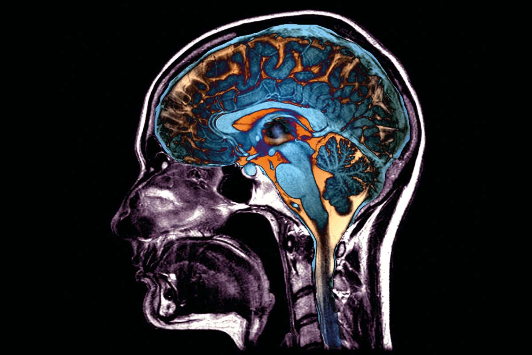 Covid-19 λειτουργίες: Προσβάλλει εγκέφαλο και μπορεί να προκαλέσει μόνιμη βλάβη