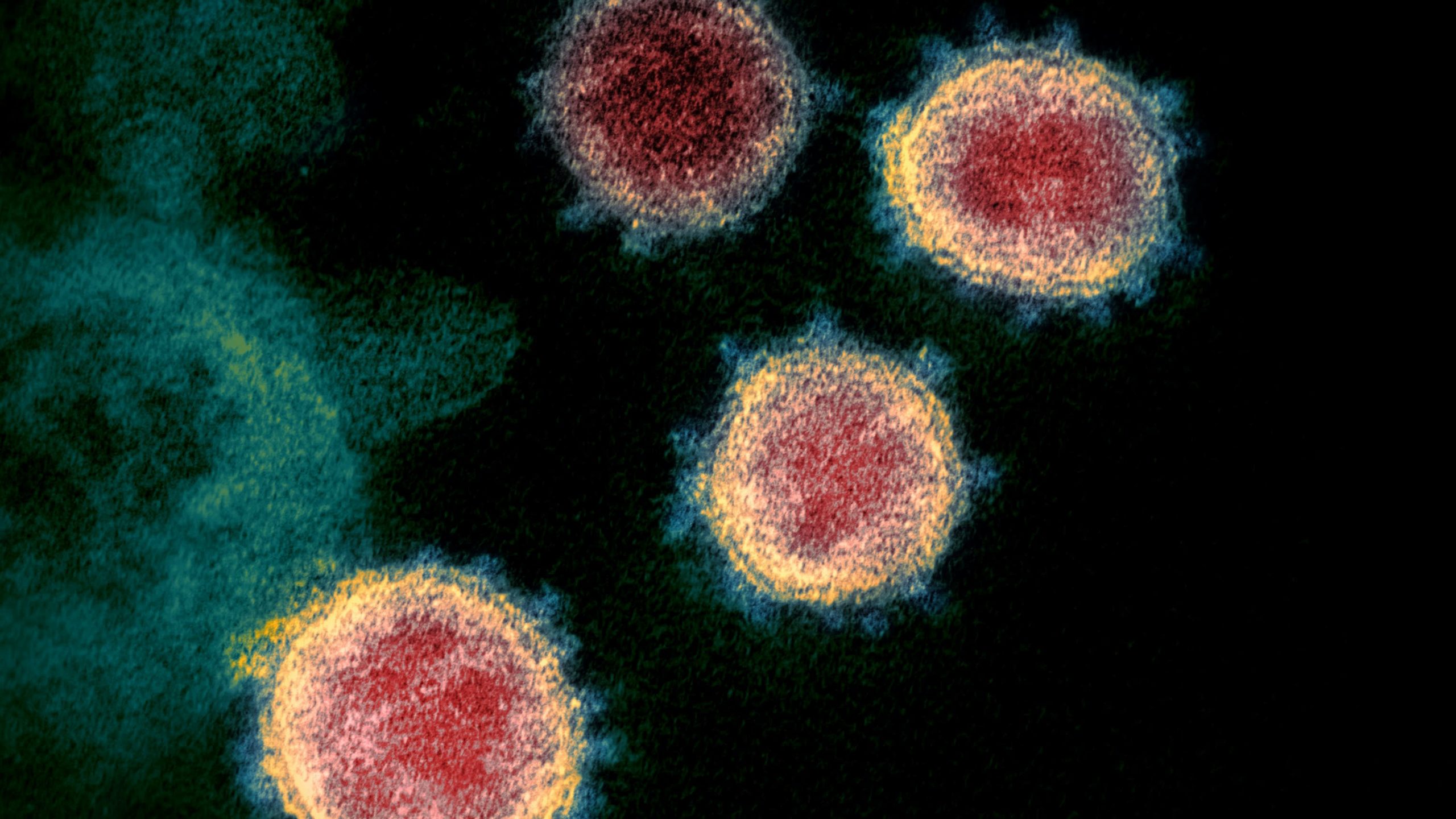 Κορωνοϊός Μετάλλαξη: Νέα παραλλαγή του ιού στην Αμερική